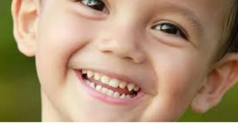 Kenali Jenis Gigi Anak Yang Rosak, Ibu Ayah Kena Alert! Kenali Jenis Gigi Anak Yang Rosak, Ibu Ayah Kena Alert!