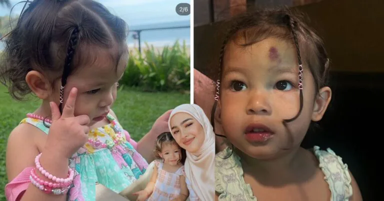 Anak Aktif Sampai Tercedera, Elfira Loy Luah Rasa Risau Anak Aktif Sampai Tercedera, Elfira Loy Luah Rasa Risau