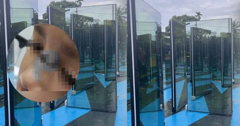 Terlanggar Cermin Hiasan Di Taman, Budak 7 Tahun Cedera Parah! Terlanggar Cermin Hiasan Di Taman, Budak 7 Tahun Cedera Parah!
